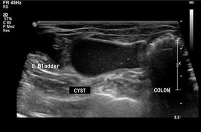 A Case of Segmental Aplasia of the Uterus, Cervix, and Cranial Vagina in a Cat